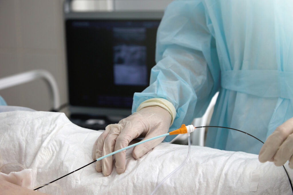 pull rings and pull wire assemblies
